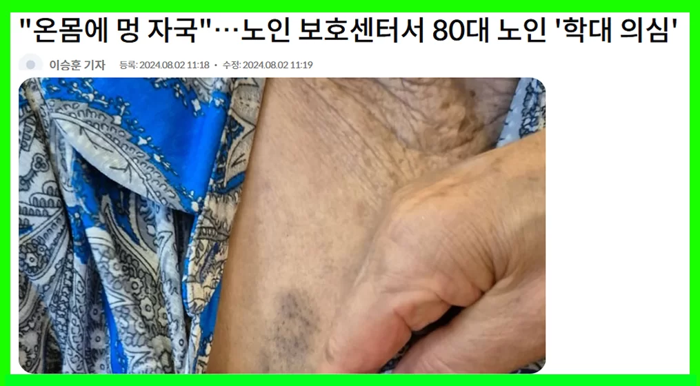 노인보호센터 80대 노인 학대 의심 보도 화면