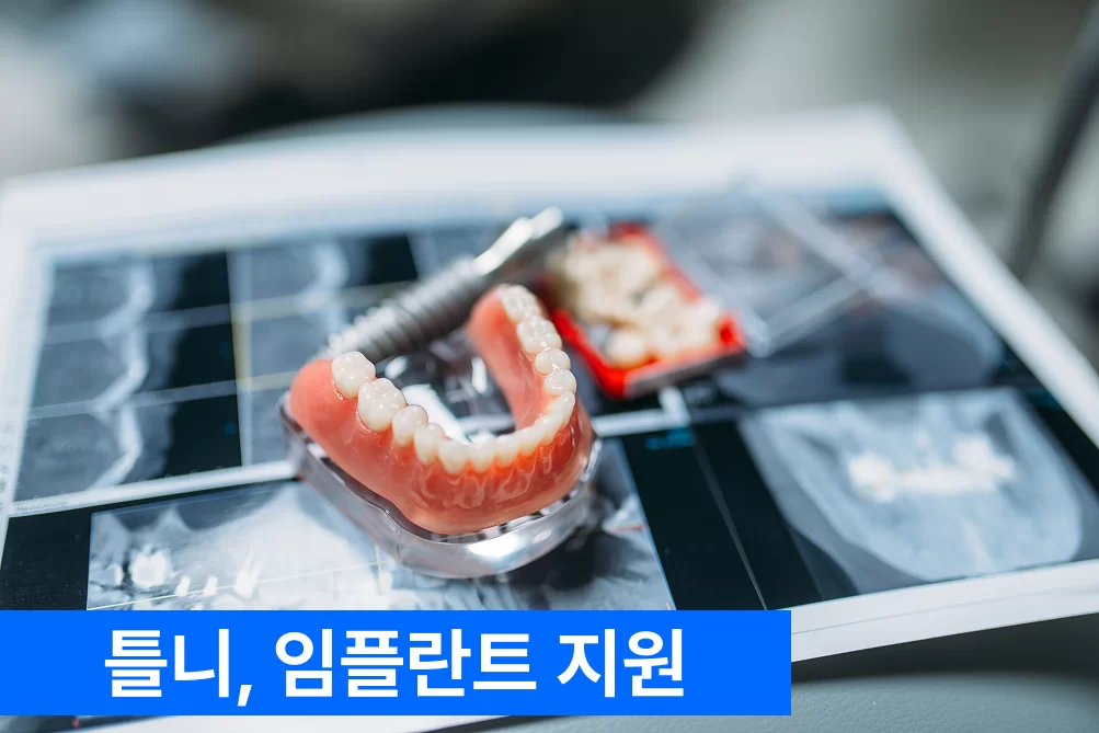 틀니와 임플란트 지원 안내 사진