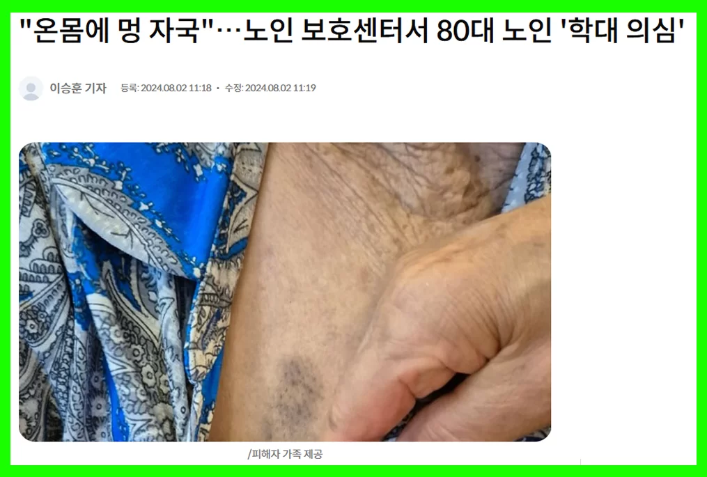 노인 보호센터 학대 의심 보도 화면