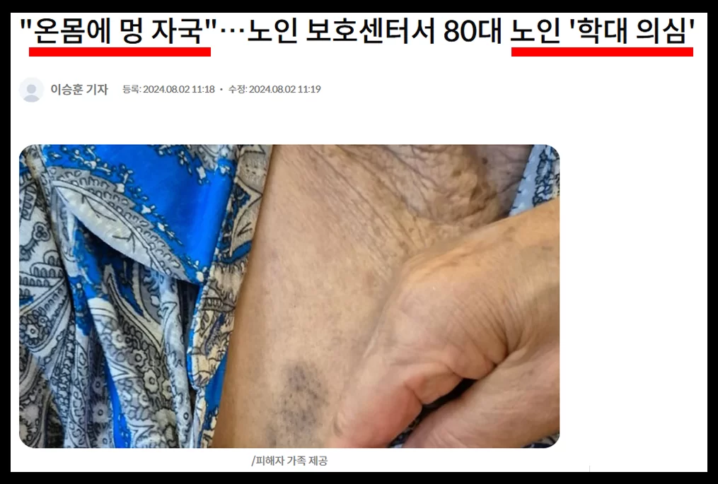 80대 노인 학대 의심을 다룬 노인 보호센터 뉴스